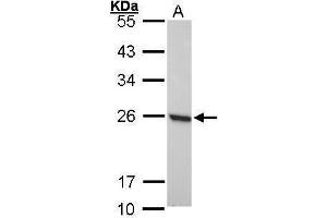 Image no. 2 for anti-Periaxin (PRX) (Center) antibody (ABIN2855135)