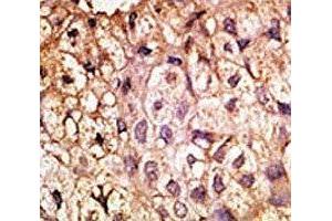 Image no. 1 for anti-Angiotensin I Converting Enzyme 2 (ACE2) (AA 59-90) antibody (ABIN3029962)