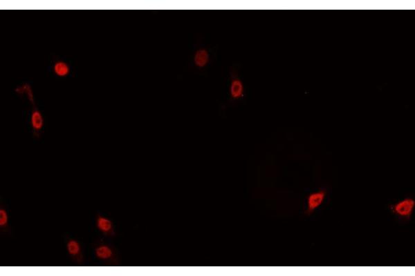 anti-Tumor Necrosis Factor, alpha-Induced Protein 8 (TNFAIP8) (Internal Region) antibody