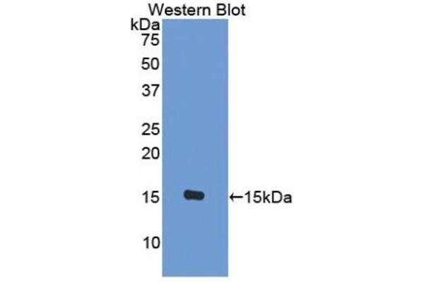 CCL8 antibody  (AA 1-99)