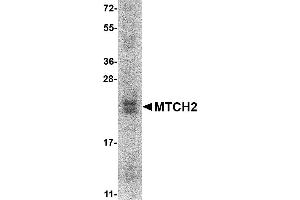 Image no. 1 for Mitochondrial Carrier 2 (MTCH2) (AA 29-174) protein (His tag) (ABIN2468870)