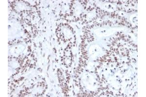 Image no. 3 for anti-Nuclear Factor (erythroid-Derived 2)-Like 1 (NFE2L1) antibody (ABIN6940224)