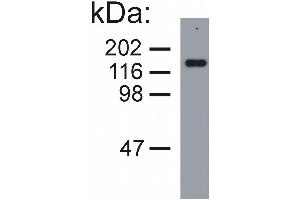 Image no. 3 for anti-Neurofilament Triplet M Protein (NEFM) antibody (ABIN94435)