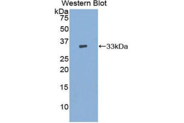 anti-Adenylate Cyclase 9 (ADCY9) (AA 1029-1282) antibody