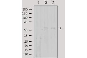 Image no. 2 for anti-Fibulin 3 (FBLN3) (Internal Region) antibody (ABIN6257847)