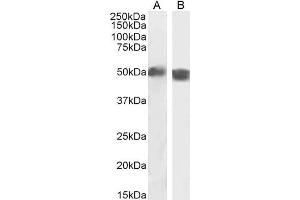 Image no. 1 for anti-TBC1 Domain Family, Member 10C (TBC1D10C) (Internal Region) antibody (ABIN190840)