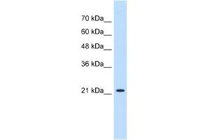 Image no. 2 for anti-Progesterone Receptor Membrane Component 1 (PGRMC1) (N-Term) antibody (ABIN635310)