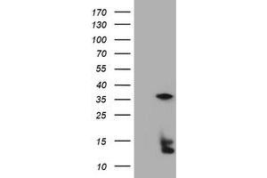 Image no. 5 for anti-Thymidylate Synthetase (TYMS) antibody (ABIN1501591)
