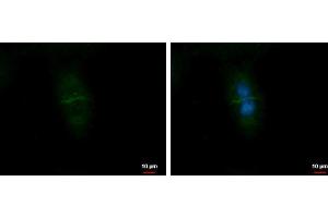 ICC/IF Image CD99L2 antibody detects CD99L2 protein at Cell membrane by immunofluorescent analysis.