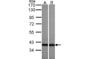Image no. 2 for anti-ArfGAP with Dual PH Domains 1 (ADAP1) (C-Term) antibody (ABIN2856370)