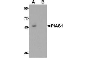 Image no. 2 for anti-Protein Inhibitor of Activated STAT, 1 (PIAS1) (C-Term) antibody (ABIN500489)
