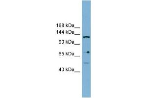 Image no. 1 for anti-Valyl-tRNA Synthetase 2, Mitochondrial (VARS2) (Middle Region) antibody (ABIN2783069)