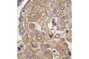 Image no. 3 for anti-Toll-Like Receptor 6 (TLR6) (C-Term) antibody (ABIN357053)