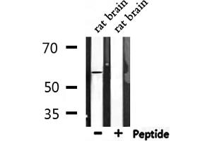 Image no. 1 for anti-Activating Transcription Factor 2 (ATF2) (pSer44), (pSer62) antibody (ABIN6255342)
