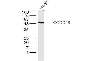 Image no. 2 for anti-Family with Sequence Similarity 175, Member A (FAM175A) (AA 51-150) antibody (ABIN872878)