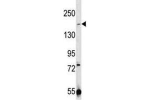 Image no. 2 for anti-Transient Receptor Potential Cation Channel, Subfamily M, Member 7 (TRPM7) (AA 1821-1850) antibody (ABIN3029239)