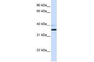 Image no. 1 for anti-UDP-Gal:betaGlcNAc beta 1,3-Galactosyltransferase, Polypeptide 1 (B3GALT1) (N-Term) antibody (ABIN635749)