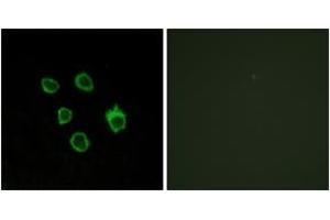 Image no. 2 for anti-Frizzled Family Receptor 5 (FZD5) (AA 31-80) antibody (ABIN1535612)