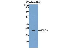Image no. 1 for anti-Gastrokine 1 (GKN1) (AA 53-192) antibody (ABIN1859011)