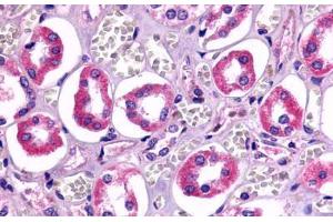 Anti-TAAR6 antibody  ABIN1049384 IHC staining of human kidney, renal tubules.