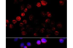Immunofluorescence analysis of HeLa cells using Aromatase Polyclonal Antibody at dilution of 1:100 (40x lens).