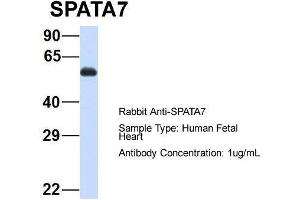 Image no. 2 for anti-Spermatogenesis Associated 7 (SPATA7) (Middle Region) antibody (ABIN2787132)