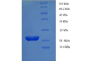Image no. 1 for Fragile Histidine Triad (FHIT) (AA 2-150) protein (His tag) (ABIN5711223)