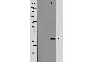 anti-Aquaporin 5 (AQP5) (C-Term) antibody