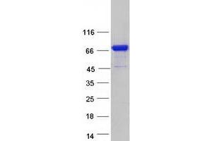 Image no. 1 for Kelch-Like 14 (KLHL14) protein (Myc-DYKDDDDK Tag) (ABIN2724117)