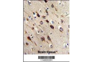 Image no. 2 for anti-Brain-Derived Neurotrophic Factor (BDNF) (AA 206-236), (C-Term) antibody (ABIN392515)