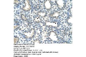 Image no. 2 for anti-Homeobox C9 (HOXC9) (Middle Region) antibody (ABIN2776470)