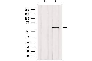 Image no. 3 for anti-Ets Variant 5 (ETV5) (Internal Region) antibody (ABIN6261622)
