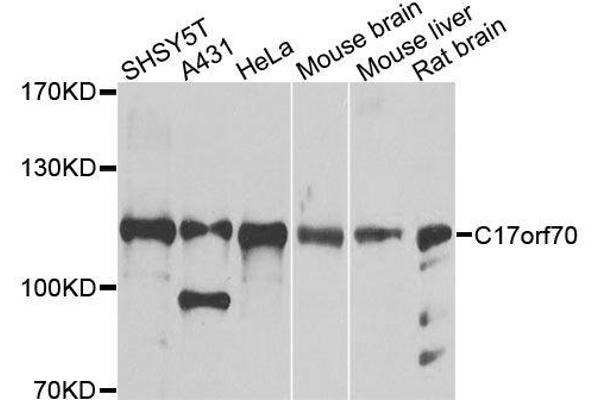 C17orf70 antibody  (AA 652-881)