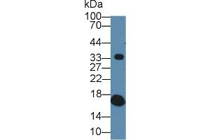 Image no. 3 for anti-Transthyretin (TTR) (AA 21-150) antibody (ABIN1863252)
