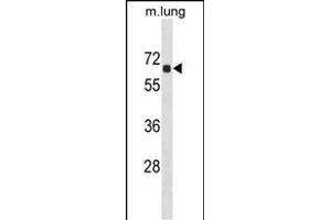 ACOT9 Antibody (Center) (ABIN1538089 and ABIN2850062) western blot analysis in mouse lung tissue lysates (35 μg/lane).