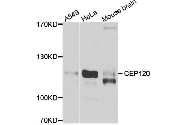 anti-Centrosomal Protein 120kDa (CEP120) antibody
