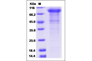 Image no. 1 for K-Cadherin (CDH6) (AA 1-615) protein (His tag) (ABIN2650848)