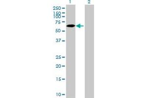 anti-Zinc Finger Protein 653 (ZNF653) (AA 1-615) antibody