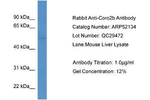 Image no. 1 for anti-Coronin, Actin Binding Protein, 2B (CORO2B) (C-Term) antibody (ABIN2784791)