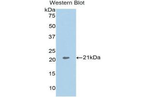 Image no. 1 for anti-Actin Related Protein 2/3 Complex, Subunit 4, 20kDa (ARPC4) (AA 3-163) antibody (ABIN1858080)