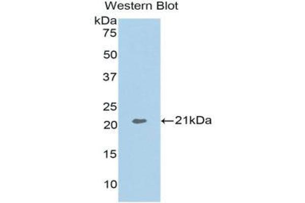 anti-Actin Related Protein 2/3 Complex, Subunit 4, 20kDa (ARPC4) (AA 3-163) antibody