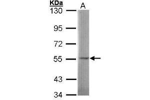 Image no. 1 for anti-N-Sulfoglucosamine Sulfohydrolase (SGSH) (Center) antibody (ABIN2854346)