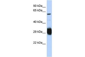 Image no. 1 for anti-SET Domain and Mariner Transposase Fusion Gene (SETMAR) (C-Term) antibody (ABIN2773983)