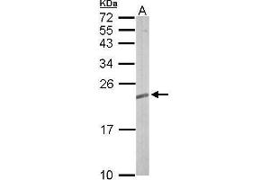 Image no. 2 for anti-Related RAS Viral (R-Ras) Oncogene Homolog 2 (RRAS2) (Center) antibody (ABIN2856766)