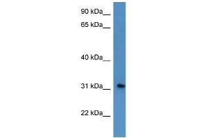 Image no. 1 for anti-Rhophilin Associated Tail Protein 1-Like (ROPN1L) (N-Term) antibody (ABIN2774290)