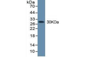 Rabbit Detection antibody from the kit in WB with Positive Control: Sample A431 cell lysate.