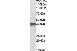 Image no. 2 for anti-Forkhead Box I3 (FOXI3) (Internal Region) antibody (ABIN625827)