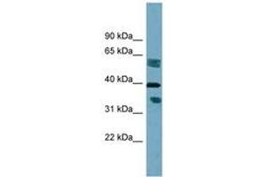Image no. 1 for anti-Dehydrogenase/reductase (SDR Family) Member 7B (DHRS7B) (AA 215-264) antibody (ABIN6742028)