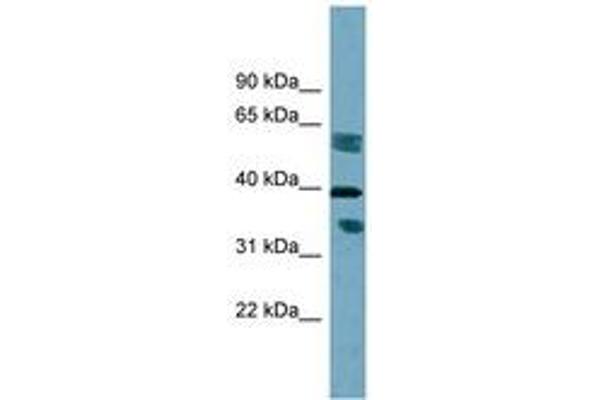 DHRS7B Antikörper  (AA 215-264)