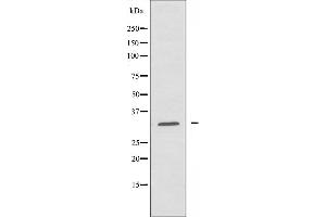 Image no. 2 for anti-Abhydrolase Domain Containing 11 (ABHD11) (C-Term) antibody (ABIN6258527)